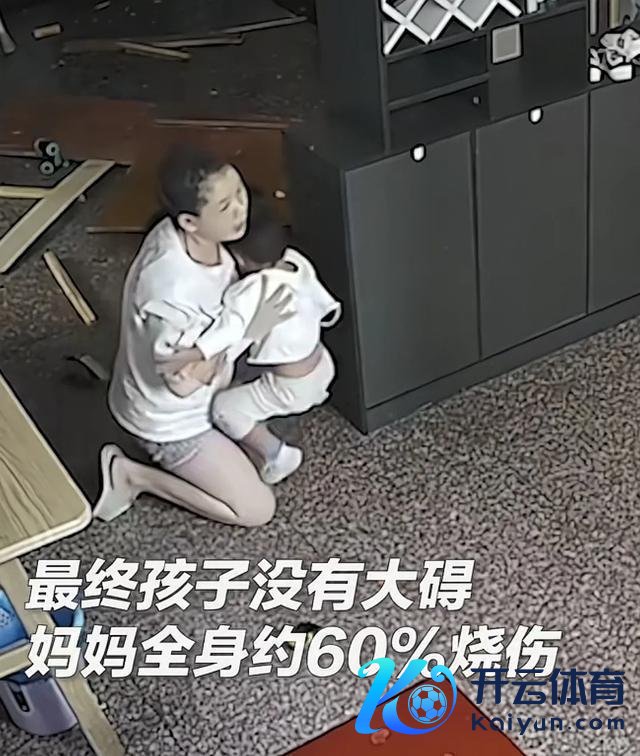 被烧伤女子为调理剪发发 丈夫也剪发 患难见真情